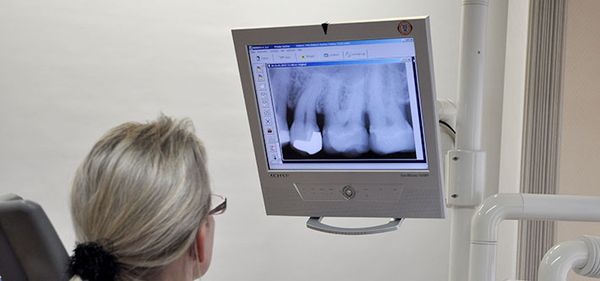 Digitales Röntgen 