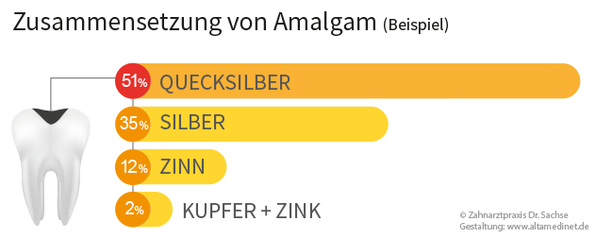 Amalgamsanierung Zusammensetzung